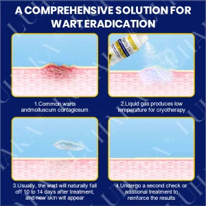 LUHAKA® SKIN TAG CRYO TREATMENT SPRAY ACE