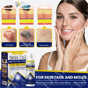 LUHAKA® SKIN TAG CRYO TREATMENT SPRAY ACE