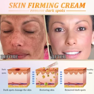 Jorondy® Anti-Glycation Skin Firming Cream