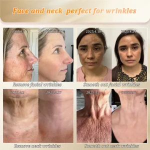 Jorondy® Anti-Glycation Skin Firming Cream