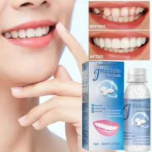 ToothEasePro™ Dental Filling Gel