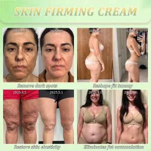 Jorondy® Skin Firming Cream