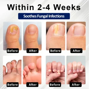 BBOJI® Fungiclear Bee Therapy Nail Spray