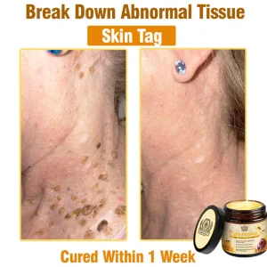 LOVILDS™ Bee Essence Skin Antibacterial Cream