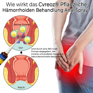 Cvreoz® Intensive Herbal Hemorrhoid Treatment Anal Spray