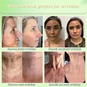 Jorondy® Skin Firming Cream