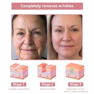 Awzlove™ Coenzyme Q10 Collagen Jelly Skin Cream