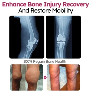 Slimoly™ Joint and Bone Recovery Cream