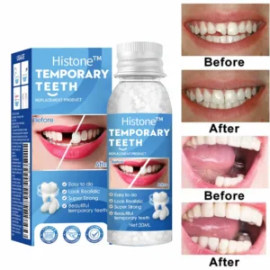 Histone™ Natural Tooth Repair Gel