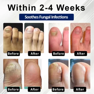 BBOJI® Fungiclear Bee Therapy Nail Spray