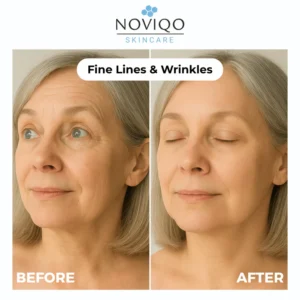 Noviqo™ – Anti-Wrinkle Freeze-Dried Nano-Silk Collagen System