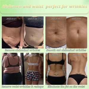 Jorondy® Skin Firming Cream