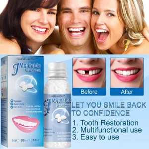 ToothEasePro™ Dental Filling Gel