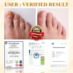 BBOJI® Fungiclear Bee Therapy Nail Spray