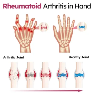 Slimoly™ Joint and Bone Recovery Cream