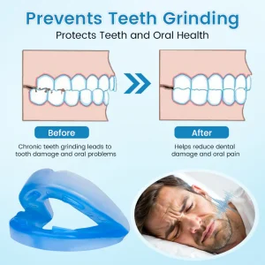 JEREMYTIS™ Adjustable Anti-Snoring Mouthpiece Universal Size