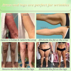 Jorondy® Skin Firming Cream