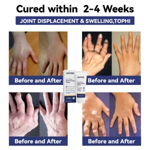 ADFIRE™ Dual Action Joint Therapy Cream