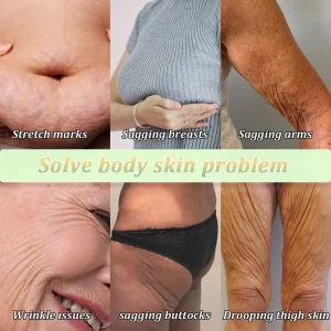 Jorondy® Skin Firming Cream