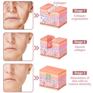 Awzlove™ Coenzyme Q10 Collagen Jelly Skin Cream