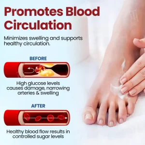 Cvreoz® Diabetic Foot Ulcer Repair Cream