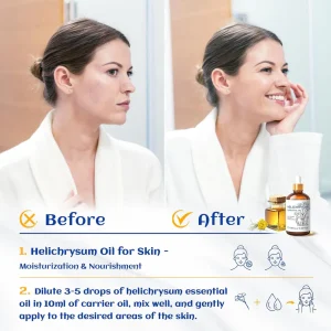 Slimoly® Helichrysum Pro Repair Oil