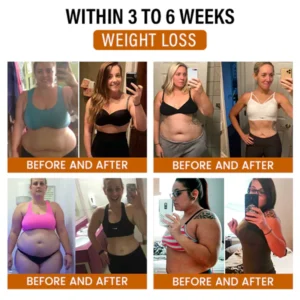 Fivfivgo® Bee Venom Lymphatic Detox Health Patches