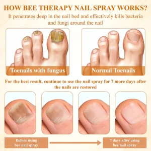 BBOJI® Fungiclear Bee Therapy Nail Spray