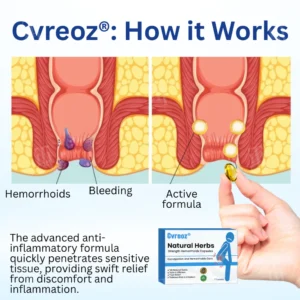 Cvreoz® Natural Herbs Strength Hemorrhoids Capsules