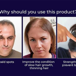 HZA™ Natural Hair Regrowth Spray