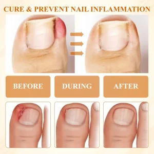 BBOJI® Fungiclear Bee Therapy Nail Spray