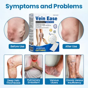 Ourlyard® Vein Ease Microneedle Care Patch - Cuttable