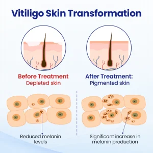 SkinPrikyn™ VitiClear Herbal Spray