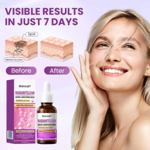 Biancat® RadiantClear Blemish & Brightening Serum