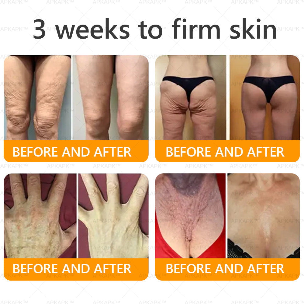 APKAPK® Bee venom Comprehensive Cream 7 APKAPK® Bee venom Comprehensive Cream