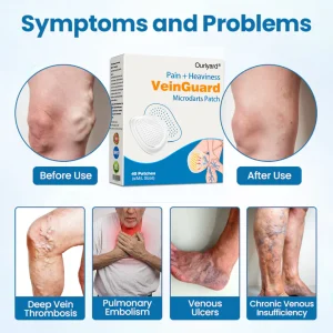 Ourlyard® VeinGuard Pain & Heaviness Microdarts Patch