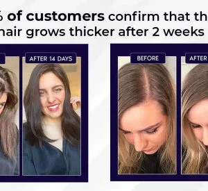 HZA™ Natural Hair Regrowth Spray