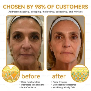 LOVILDS™ Bee Essence Skin Antibacterial Cream