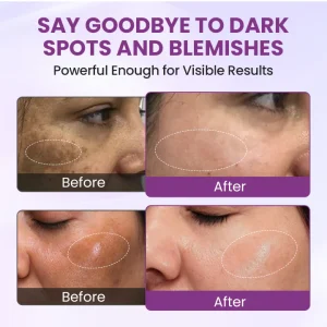 Biancat® RadiantClear Blemish & Brightening Serum