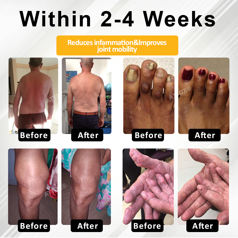 ATTDX® ApiMotion Herbal Joint Comfort Balm 7 ATTDX® ApiMotion Herbal Joint Comfort Balm