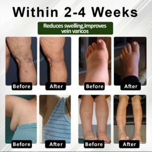 ATTDX® HormoBalance Edema Ear Patch