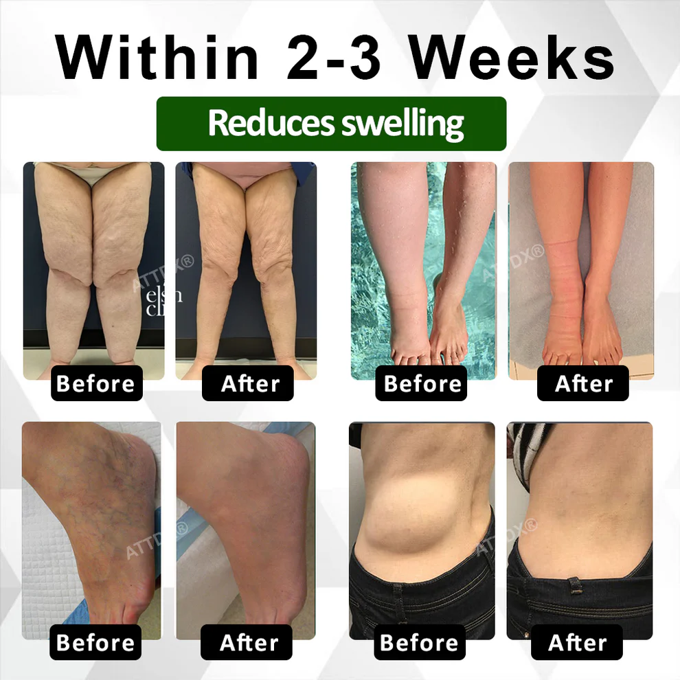 ATTDX® ClearCirculate Soursop Edema Detox Drops 3 ATTDX® ClearCirculate Soursop Edema Detox Drops