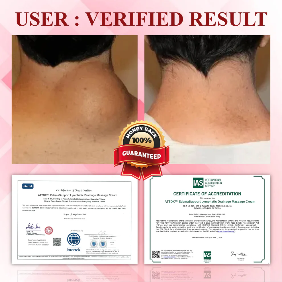 ATTDX® EdemaCare Lymphatic Drainage Massage Cream 4 ATTDX® EdemaCare Lymphatic Drainage Massage Cream
