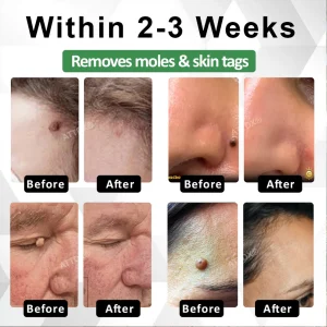 ATTDX® Herdle Shot Spot & Mole Correct Serum