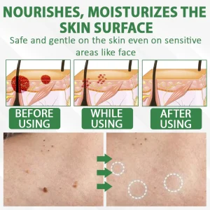 ATTDX® Herdle Shot Spot & Mole Correct Serum