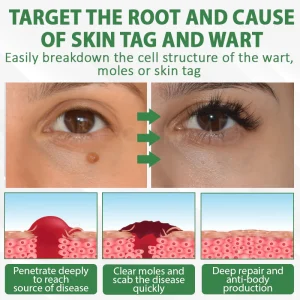 ATTDX® Herdle Shot Spot & Mole Correct Serum