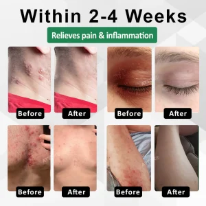 ATTDX® Snake Peptide Shingles Skincare Ampoules