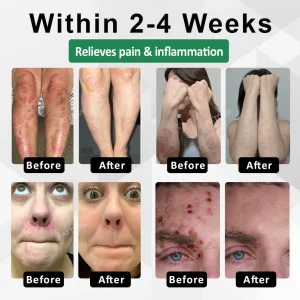 ATTDX® Snake Peptide Shingles Skincare Ampoules