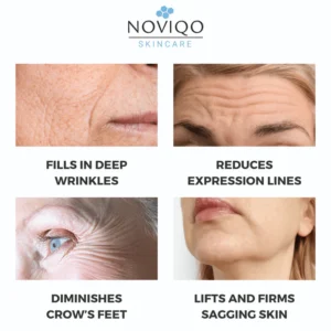 Noviqo™ – Anti-Wrinkle Freeze-Dried Nano-Silk Collagen System