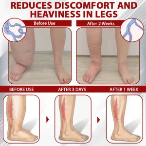 ATTDX® Red Vine FluidRelief Edema Gel